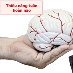 Bổ Não